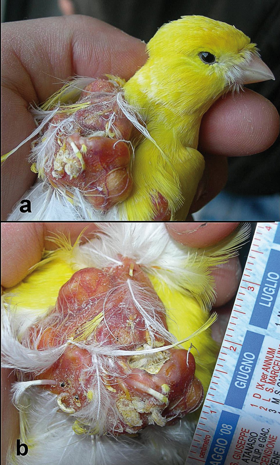 Hipopteronosis quística